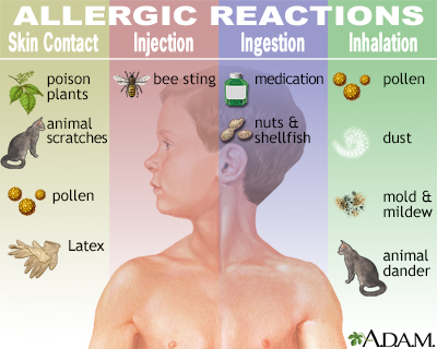 A person with red, watery eyes and a runny nose, indicative of allergic reactions. This image represents the potential health consequences of exposure to allergens, such as mold spores, in an indoor environment.